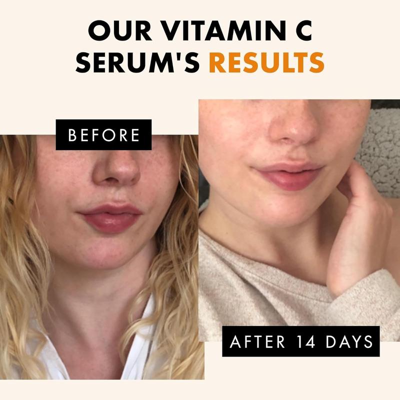 Vitamin C Face Serum - Dark Spot Remover Facial Serum, Vit C Serum with Hyaluronic Acid, Ferulic Acid, & Vit E - anti Aging and Skin Brightening Serum, Pure Vitamin C Serum Skin Care 30 Ml Eclat Skincare