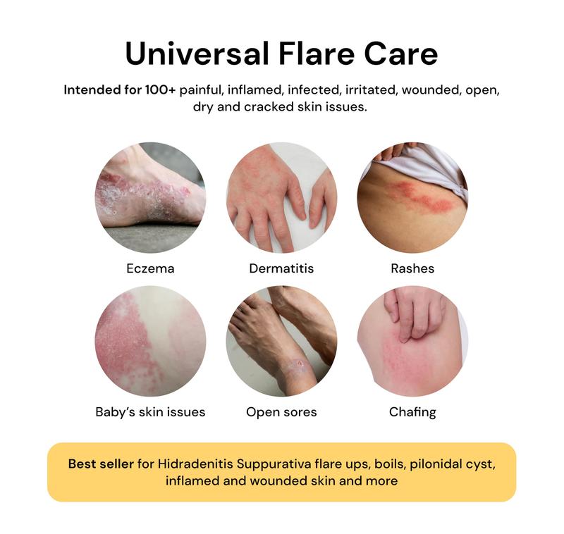 Universal Skin Healer | All Natural Flare Care | Eczema, Dry, Irritated and Cracked Skin | Made with Egg Yolk Oil and Propolis (4oz)