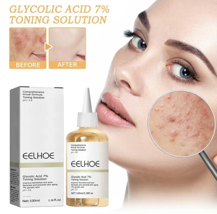 100ml Glycolic Acid 7% Skin Repair Exfoliating Toner Glycolic Sour 7% Toning, Wrinkle Exfoliating Serum for Face, Exfoliate, Hydrates & Reduces Skin Blemishes Skincare Smoother Aloe Delicate Facial Sensitive Gentle Gift Mom Comfort Hydrating Aloe brighten