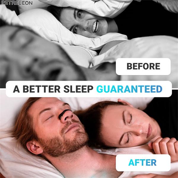 SZ-Hot Selling-Intake Breathing Nasal Strip Starter Kit,Boost Oxygen Intake, Reduce Snoring, Improve Sleep Quality,safe and effective - Intake Nasal Dilators can be combined with other sleeping aids like nasal sprays