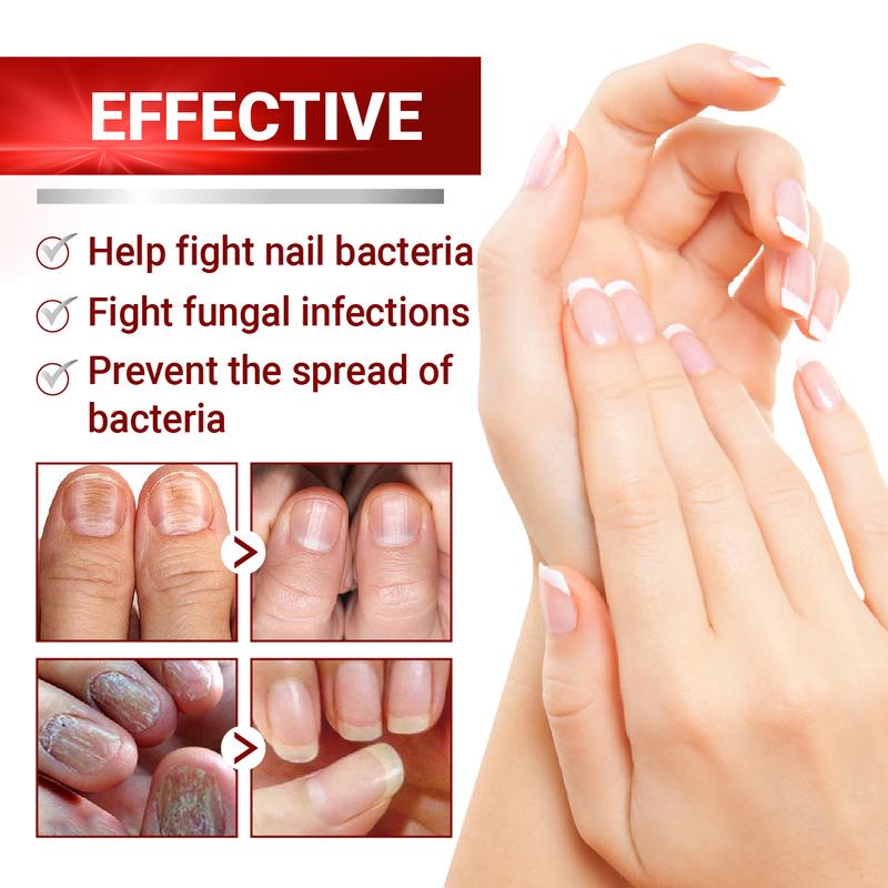 ABERA Nail Fungus Serum 20ml - Healthy Nail Care