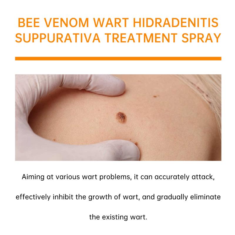 Bee Venom wart and tags removal treatment spray Acne Skincare Gentle Salicylic Soothing Skin Repair