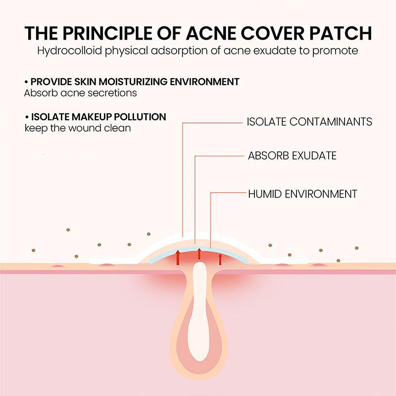 Acne Pimple Patch, 1 Pack 3 Packs(200pcs pack) Acne Covering Stickers, Acne Absorbing Cover Patches, Skin Care Products for Women & Men