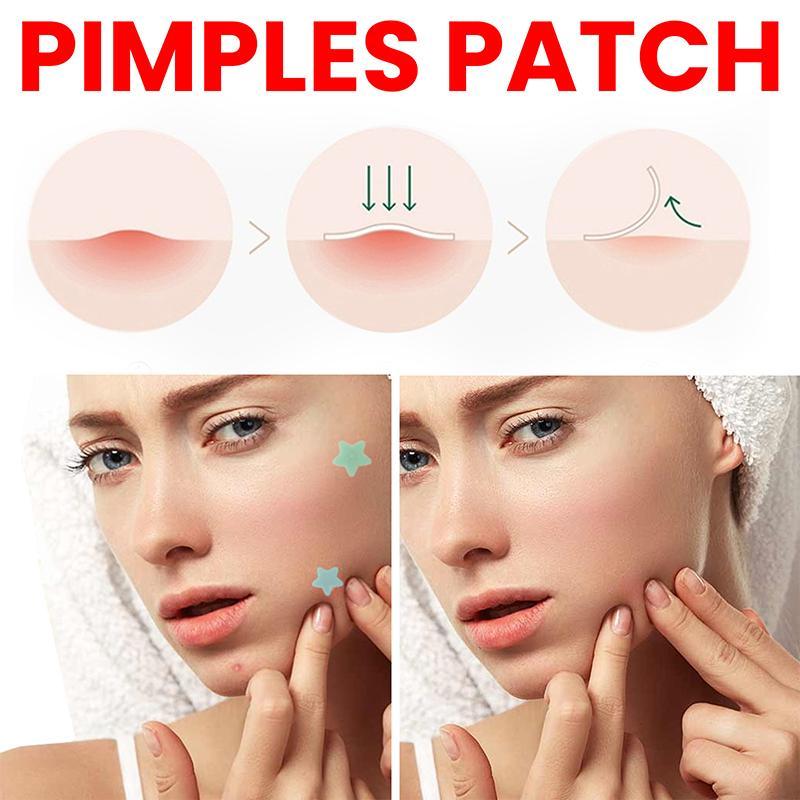 Acne Pimple Patch, 1 Pack 3 Packs(200pcs pack) Acne Covering Stickers, Acne Absorbing Cover Patches, Skin Care Products for Women & Men