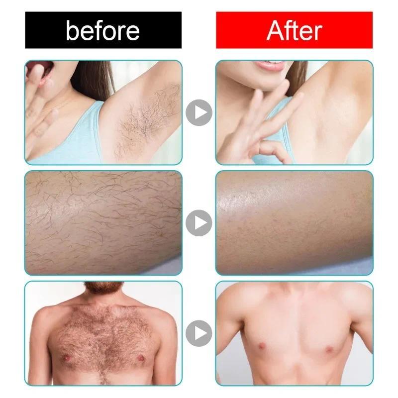 Women Intimate Area Depilatory Paste Men Armpits Leg Hair Removal Cream Body Painless Fast Depilatory Cream Face Hair Remover