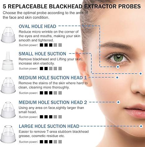 Blackhead Remover Pore Vacuum Kit - 2024 Upgraded Blackhead Extractor Tool with 3 Adjustable Suction Levels, 5 Probes, USB Rechargeable, Suitable for Women and Men,Delivery 3-7 days Facial Comfort