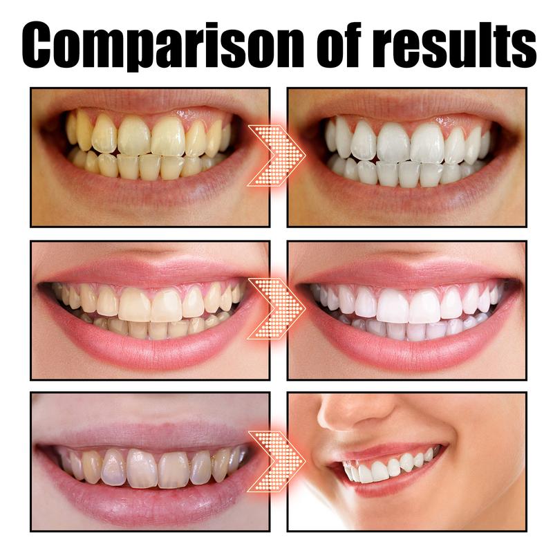 Pulling Oil Oral Rinse, To Tartar Very Well Beautiful Teeth And Fresh Breath Clean Oral Care Gums Coconut Mint