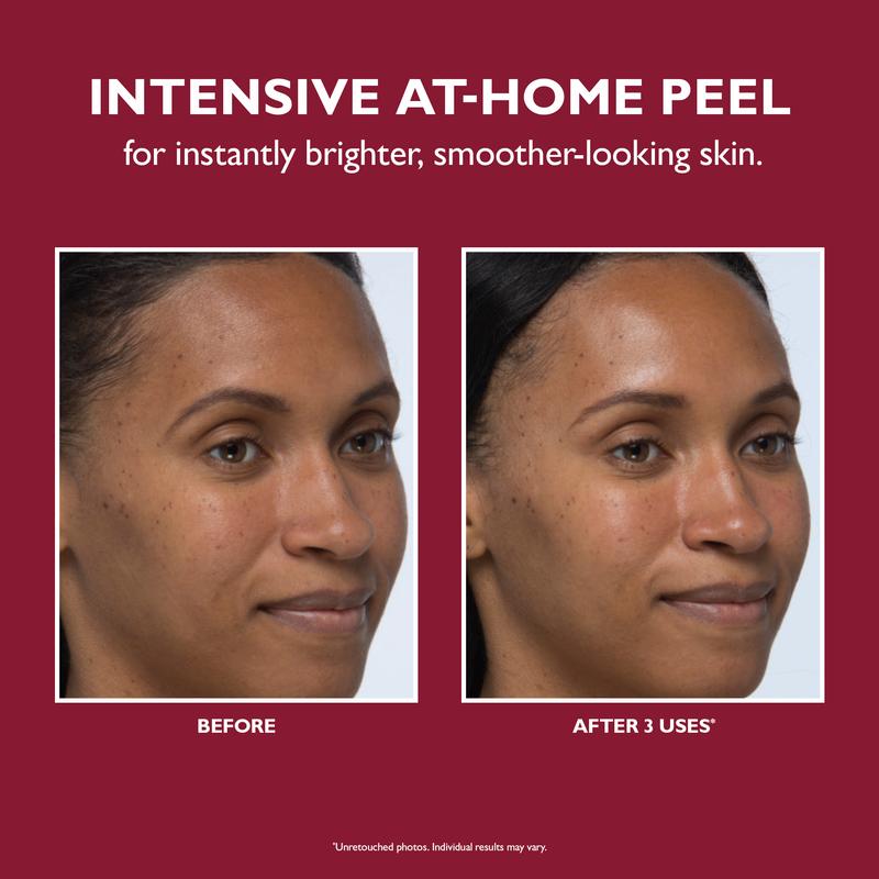 Peter Thomas Roth Even Smoother Instant Reveal Facial Peel