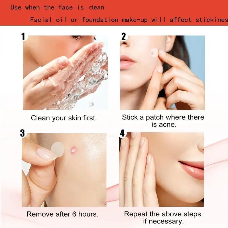 Deep Moisturizing Invisible Skincare Acne Cover Patch, 72pcs 180pcs Professional Mixed Size Acne Cover Sticker, Facial Pimple Zits Cover, Skin Care Product