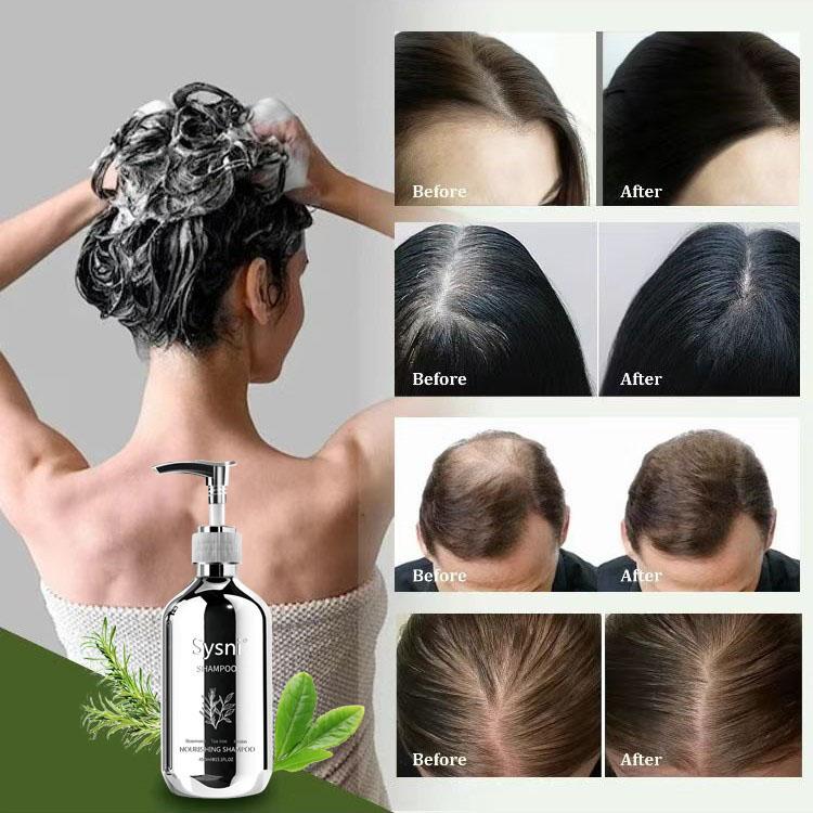 Sysni Organic Rosemary Shampoo and Tea Tree Special Shampoo, keratin nourIshing shampoo ,Promote Hair Growth, Strengthening Shampoo, Prevent Hair Loss Cleansing Shampoo,Deep Cleans, Refreshes Scalp, For All Hair Types, Especially Oily Hair