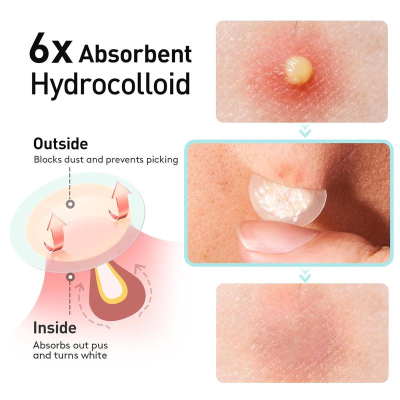 Pimple Patches, 12 mm Invisible Acne Patches for Face with Salicylic Acid, 0.01cm Extra Thin Outer Edge, Hydrocolloid Zit Patch for Pustule, Whitehead, Cystic Acne Spot, 48 Count