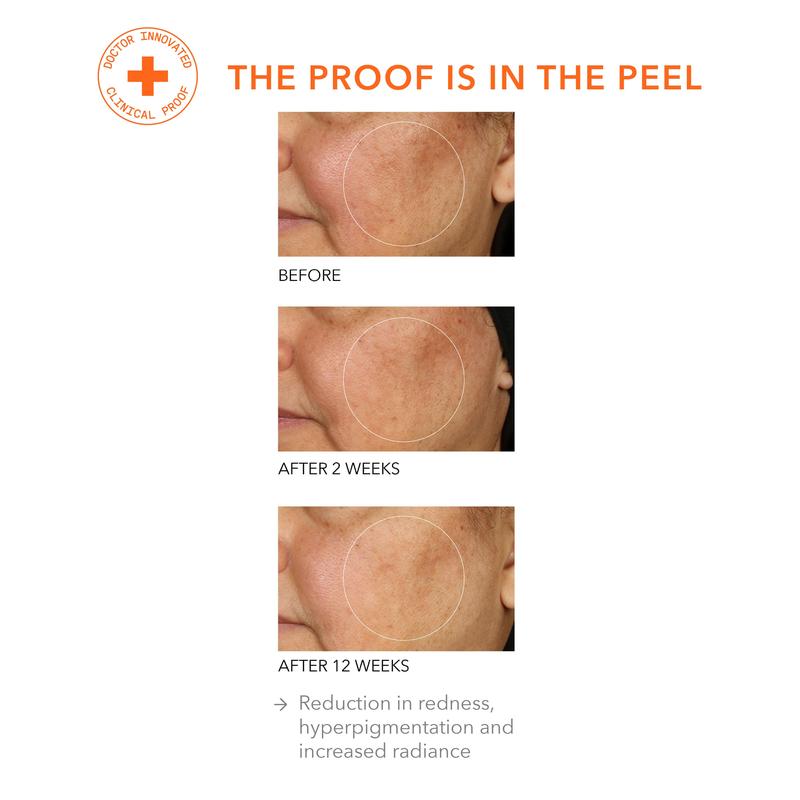 Alpha Beta® Universal Daily Peel