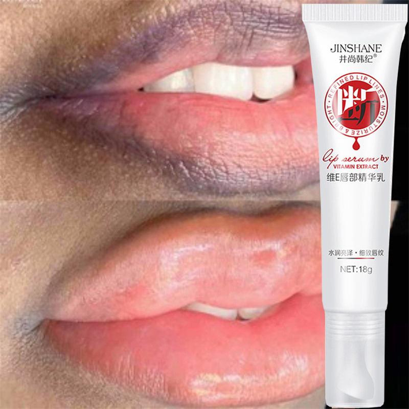 Remove Dark Smoke Lips Pink Fresh Lightening Bleaching Cream Treatment  Lip Balm Whitening Moisturizer Nourishing Essence Lips