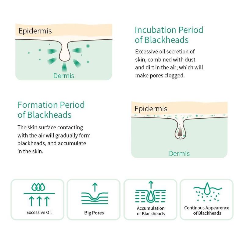 BREYLEE Tea Tree Blackhead Mask Pore Minimizer Serum New Version Shrink Pore Remove Blackhead Deep cleaning Skincare New Upgrade 17ml