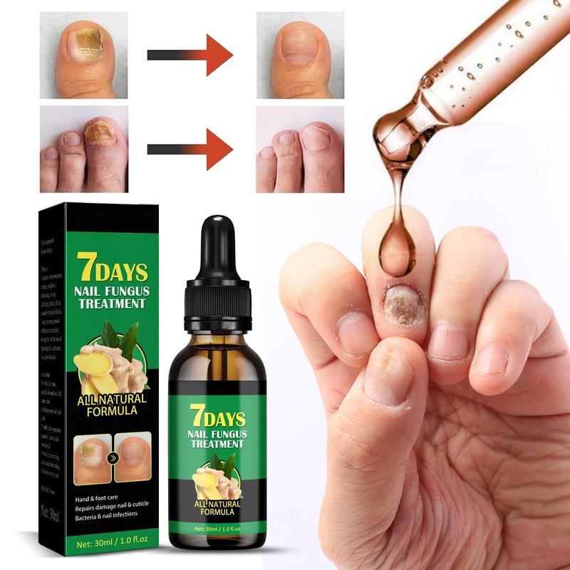 Ginger Nail Repair Serum for Dry & Brittle Nails | Daily Antibacterial Strengthening Treatment Ginger Nail Ginger Nail