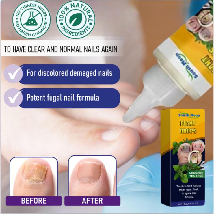 South Moon Tea Tree Oil + Oregano Oil Instant Itch Relief Nail Support Healthy Nail Care - Nail Care, Nail Art | Buy 2, get 100% Pure Batana Shampoo.