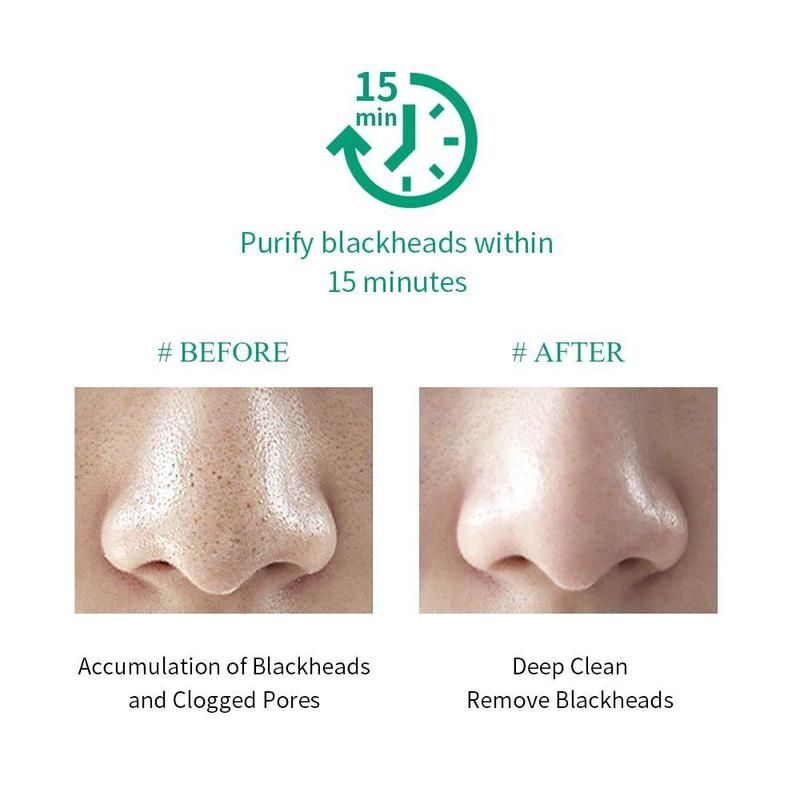 BREYLEE Tea Tree Blackhead Mask Pore Minimizer Serum New Version Shrink Pore Remove Blackhead Deep cleaning Skincare New Upgrade 17ml