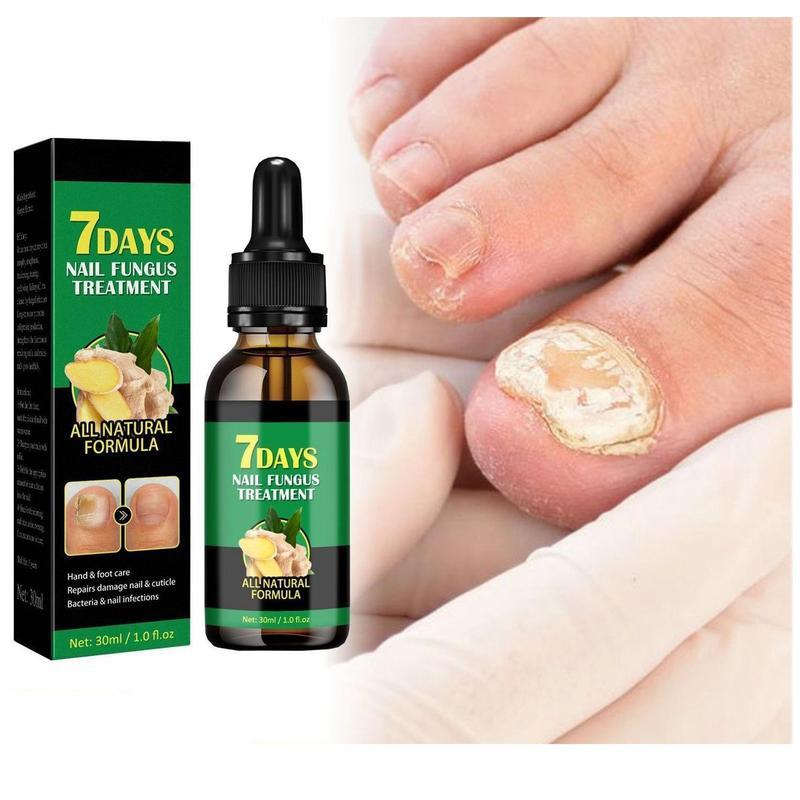 Ginger Nail Repair Serum for Dry & Brittle Nails | Daily Antibacterial Strengthening Treatment Ginger Nail Ginger Nail